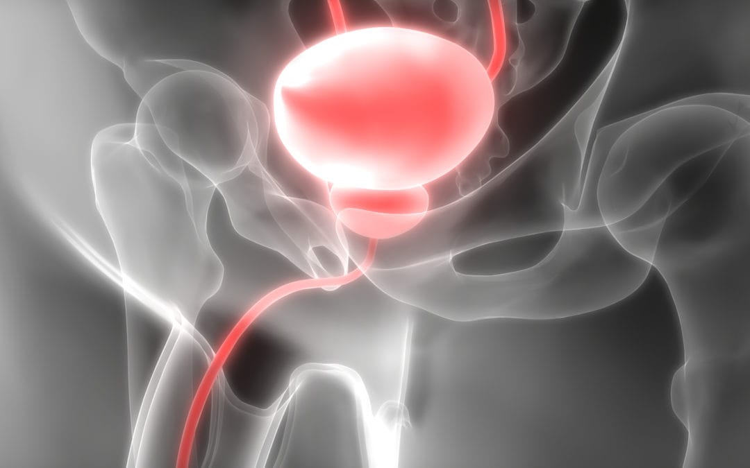 Etude PRECOCE – Hypertrophie bénigne de la prostate